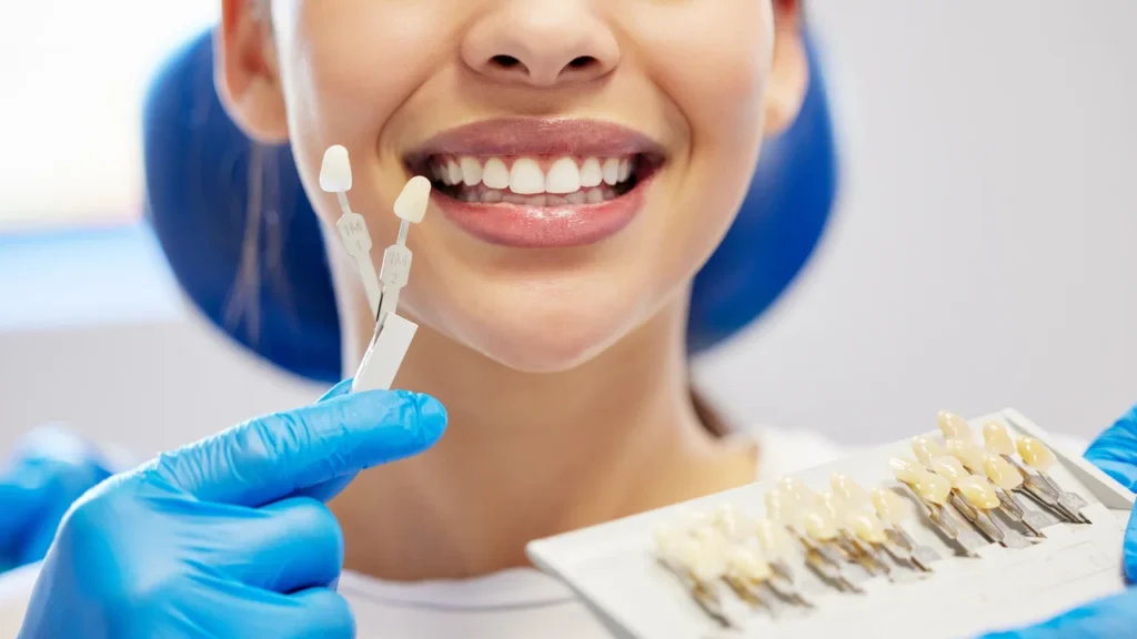 Donna con in mano delle faccette dentali